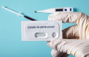Rapid Antigen Wajib Bagi ASN dan Pengunjung Balaikota Ambon