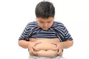 Dianggap Bukan Penyakit, Obesitas Justru Ancam Picu Komplikasi