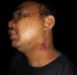 Kapolsek Randublatung: Tidak Ada Anggota TNI Terlibat Dugaan Penganiayaan