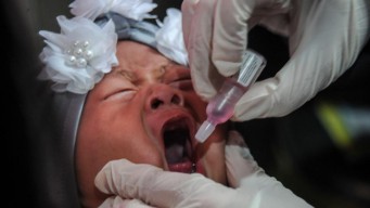 Jangan Sampai Ketinggalan, Ayo Imunisasi Polio Gratis di Puskesmas Terdekat!