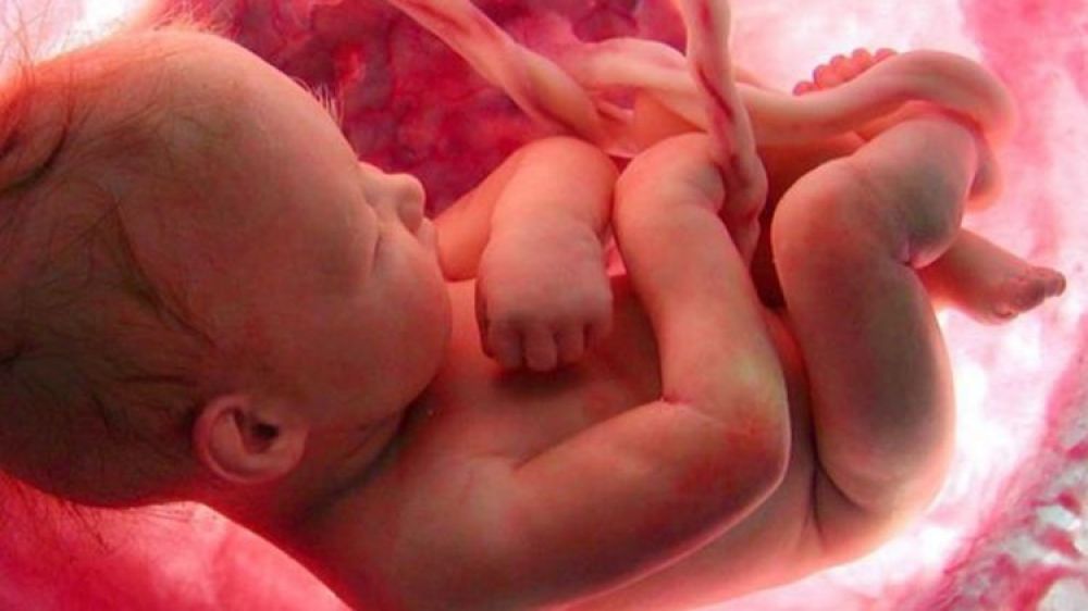 Ilustrasi aborsi (Foto: ist)