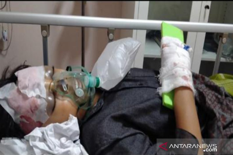 Santri yang mengalami geger otak akibat menjadi korban kekerasan di salah satu pondok pesantren di Kabupaten Pamekasan, Madura, Jawa Timur, saat menjalani perawatan di RSUD dr Slamet Martodirjo Pamekasan, Minggu (3/1/2020). (Abd Aziz)