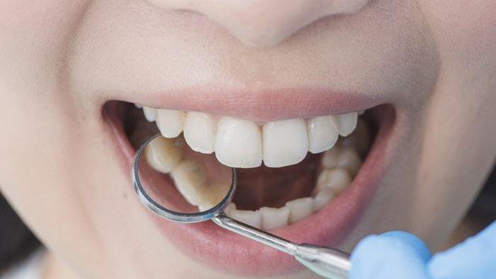 Sebagian besar masyarakat Indonesia, terutama anak-anak merupakan sweet tooth, atau penggemar makanan manis, padahal makanan manis justru dapat merusak gigi.
