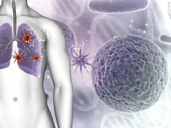 Tahun 2022 Kementerian Kesehatan bersama seluruh tenaga kesehatan berhasil mendeteksi tuberculosis (TBC) sebanyak lebih dari 700 ribu kasus. Angka tersebut merupakan angka tertinggi sejak TBC menjadi program prioritas Nasional.